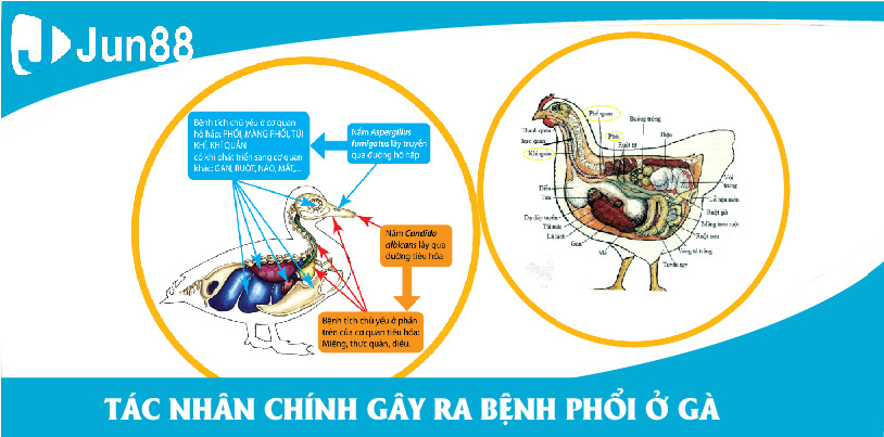 Tác nhân chính gây ra căn bệnh phổi chính là do một loại nấm